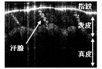 コースE:KTN結晶を用いた高速掃引OCT光源